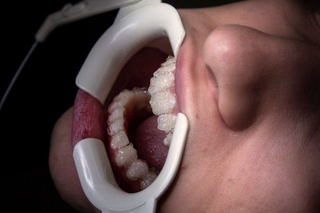 Dry Mouth at Night
